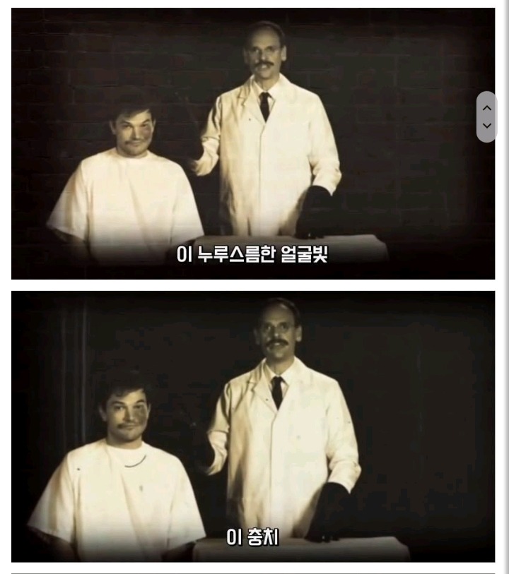 미국에서 포경수술을 많이 하는 이유 | 인스티즈