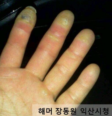 운동선수들의 손바닥 사진 | 인스티즈