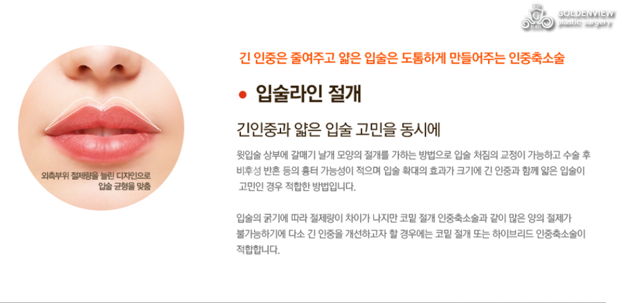 인중 이미지