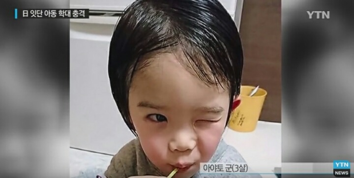 일본 아동학대 살인.gif | 인스티즈