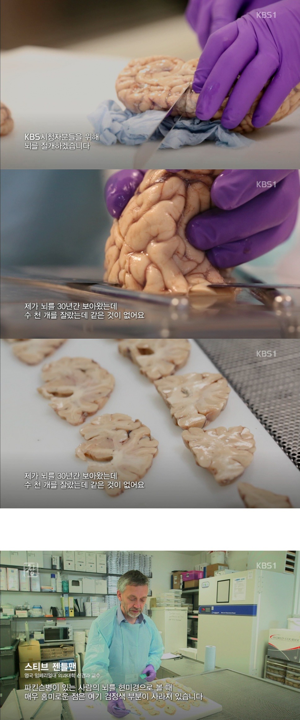 실제 사람의 뇌 | 인스티즈