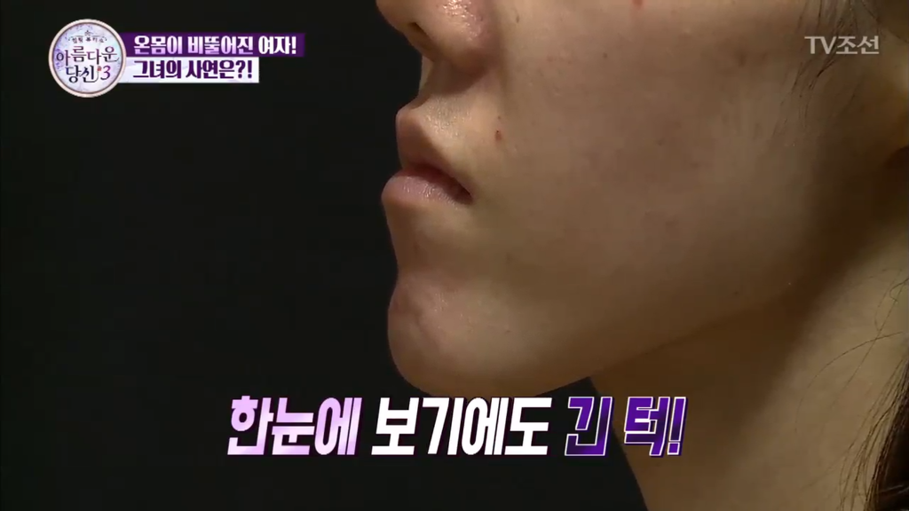 부정교합을 방치하면 안되는 이유 | 인스티즈